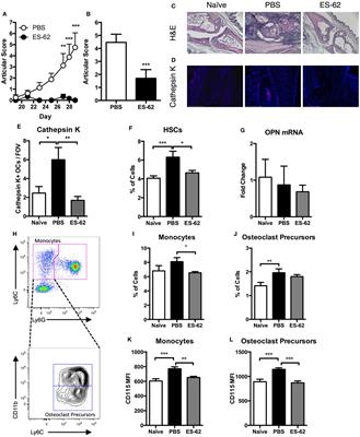 Protection Against Arthritis by the <mark class="highlighted">Parasitic Worm</mark> Product ES-62, and Its Drug-Like Small Molecule Analogues, Is Associated With Inhibition of Osteoclastogenesis